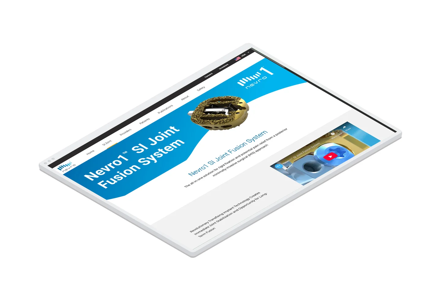 The SI Joint Fusion page on the main nevro.com website